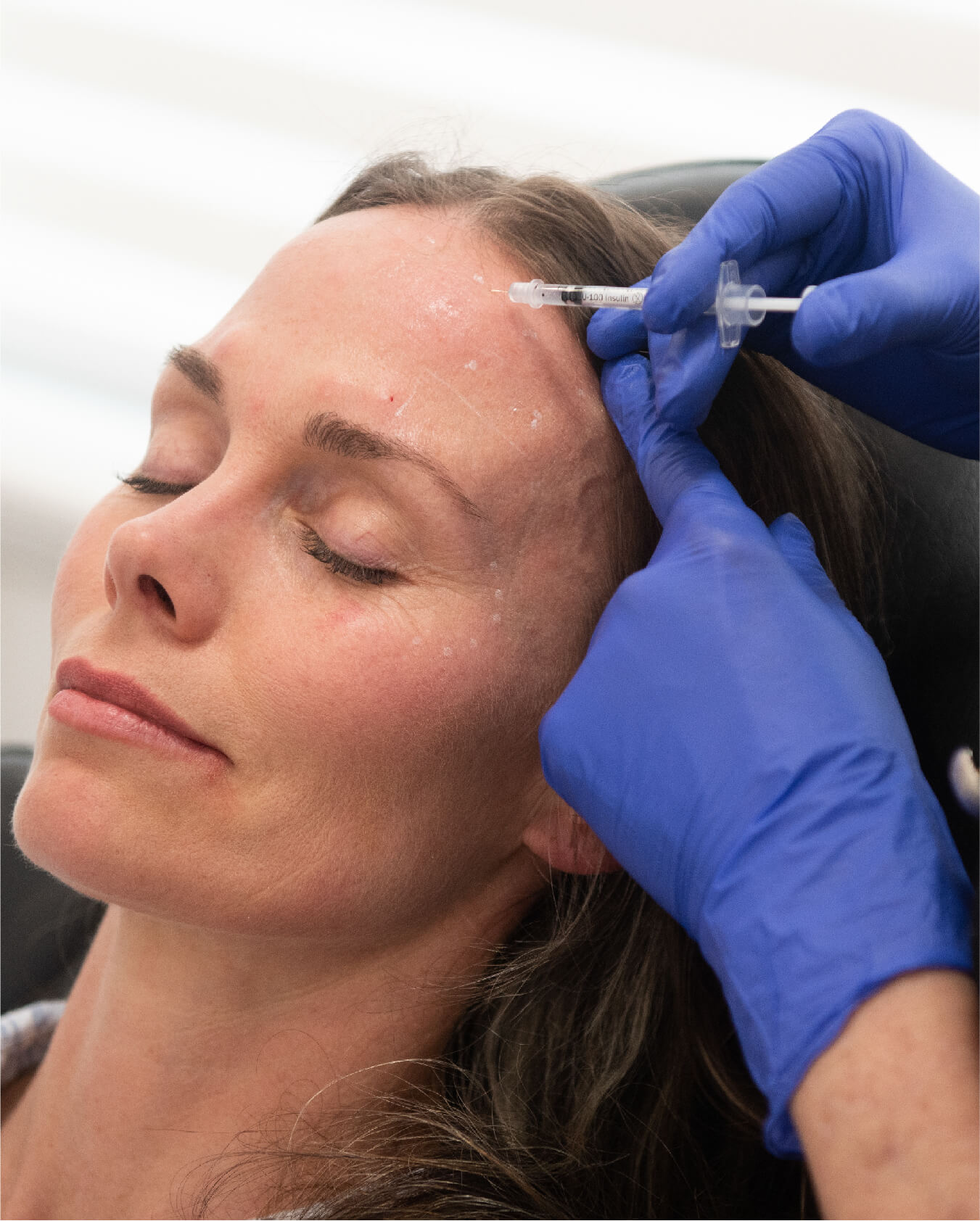 https://identia.digital/stlaurent/wp-content/uploads/2024/05/Autres_traitements_Neuromodulateurs.jpg