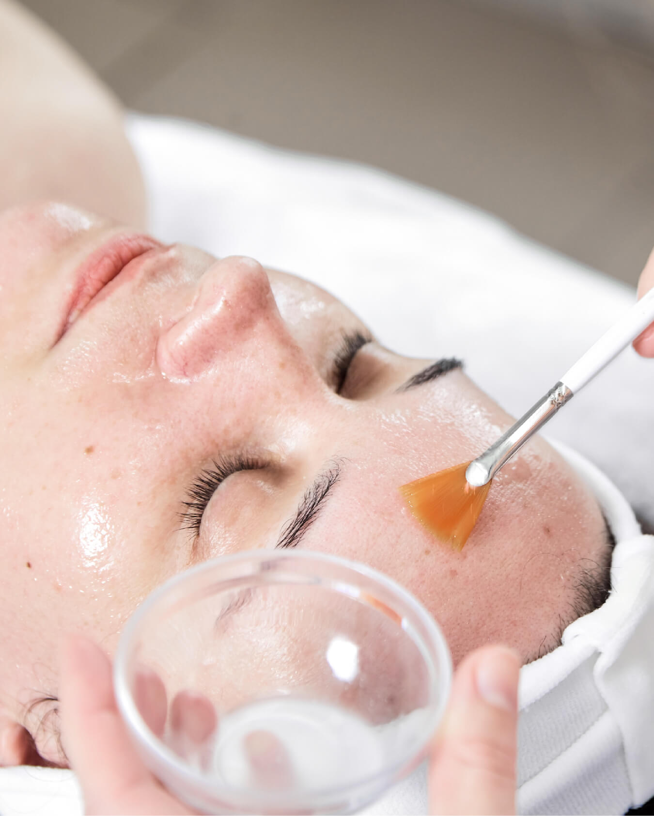 https://identia.digital/stlaurent/wp-content/uploads/2024/05/Autres_traitements_Peeling_Glycolique.jpg