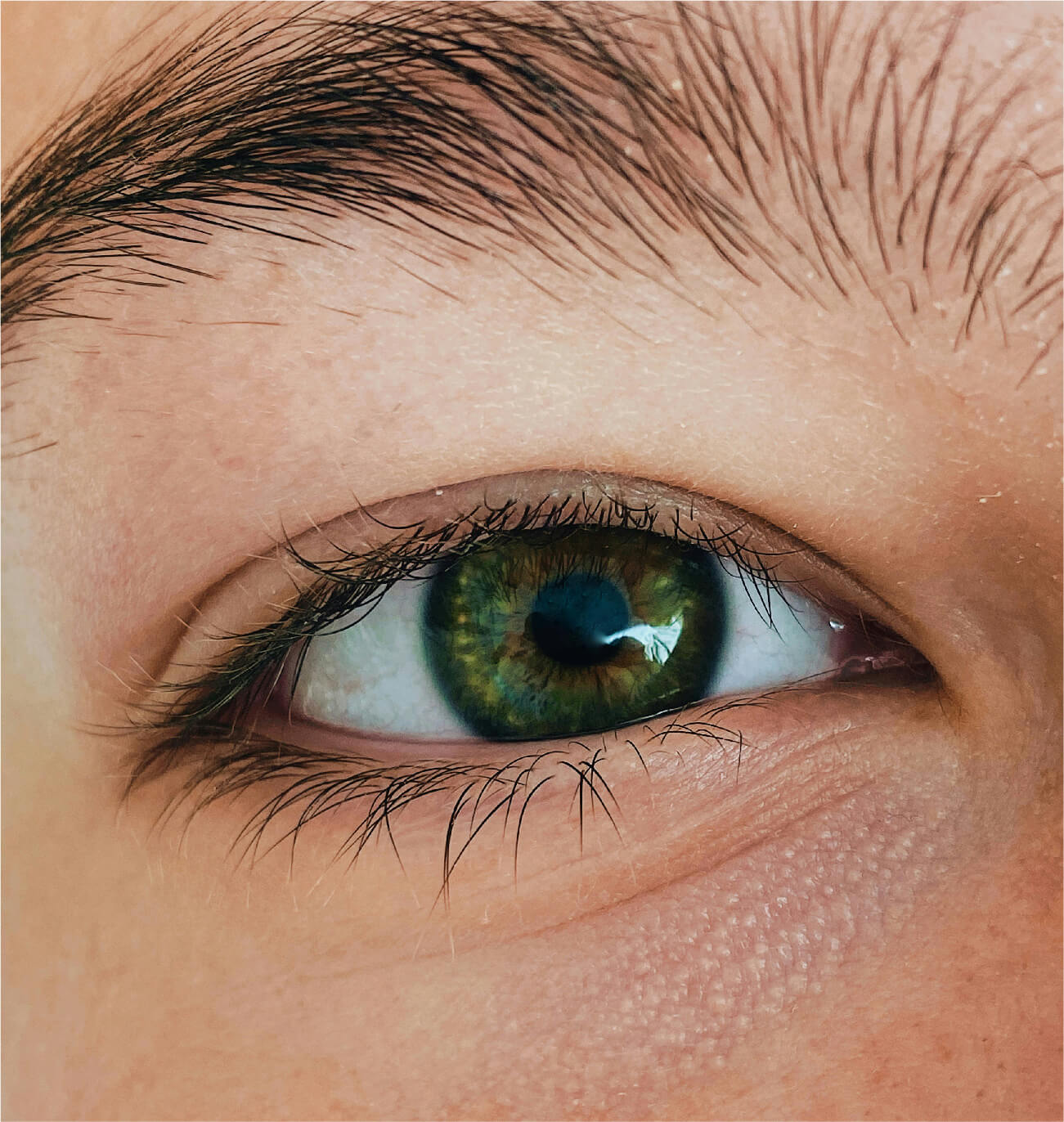 Zoom sur un œil vert éclatant illustrant les résultats du peeling Me-Line pour le contour des yeux, réduisant les cernes et ravivant l’éclat du regard