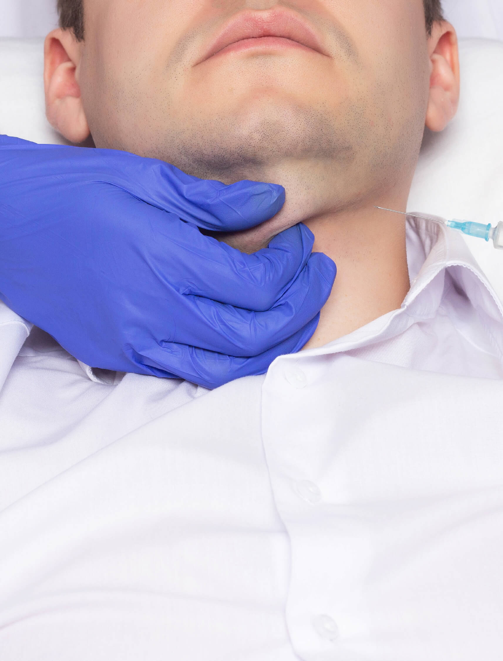 Injection sous le menton d’un patient masculin par un professionnel portant des gants bleus pour traiter la graisse sous-mentonnière.”