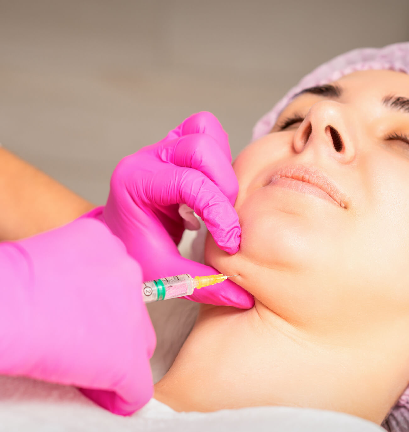 Injection esthétique administrée sous le menton d’une patiente par un professionnel portant des gants roses, pour réduire la graisse sous-mentonnière.