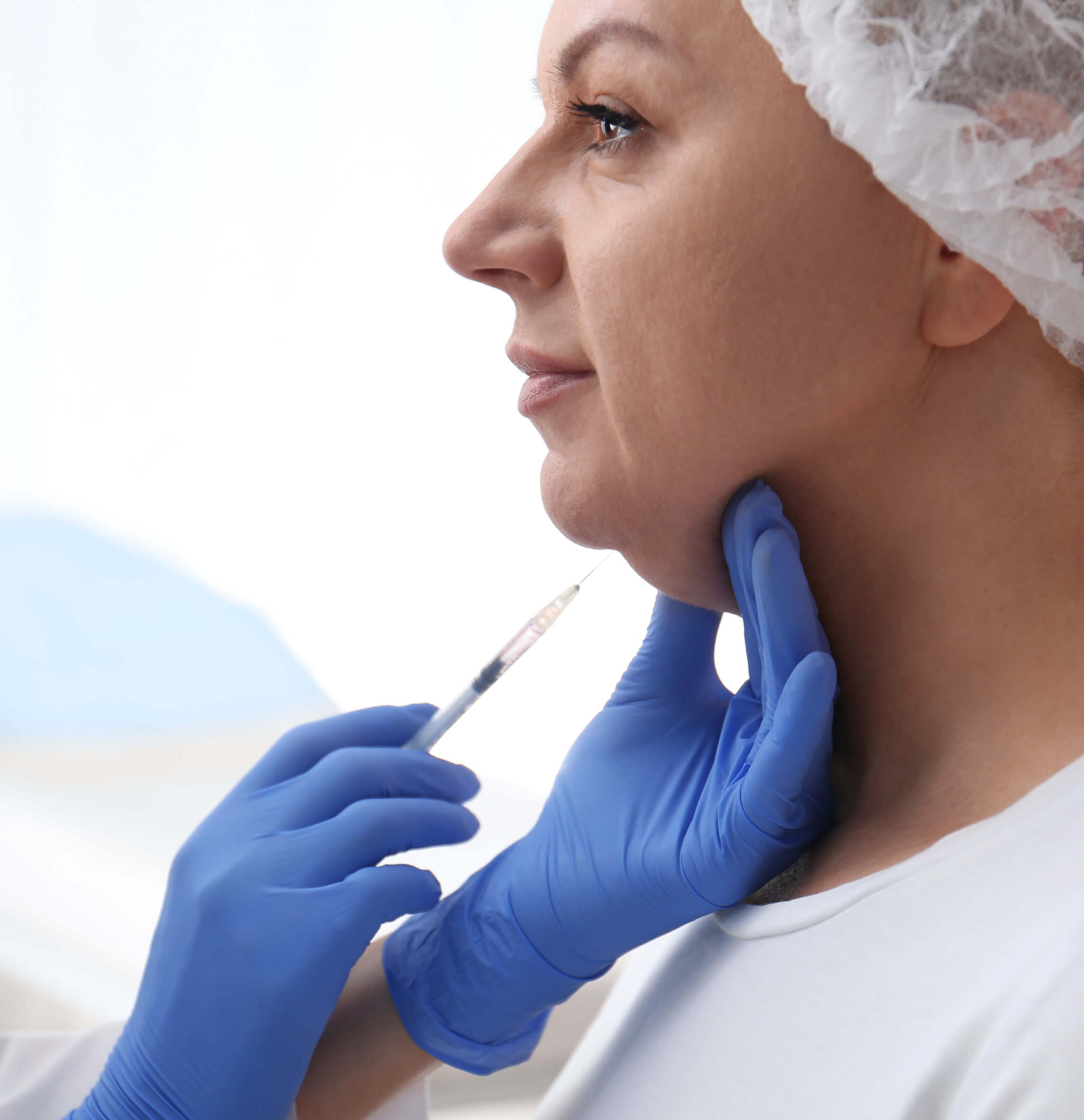 Injection de Belkyra pour traiter le double menton chez une personne