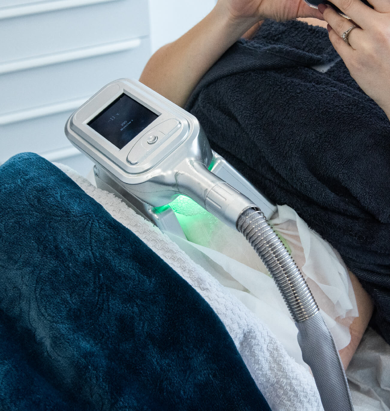Appareil de cryolipolyse ColdSculpting appliqué sur la zone abdominale d’un client, traitement esthétique non invasif de réduction des graisses, avec affichage numérique du dispositif.