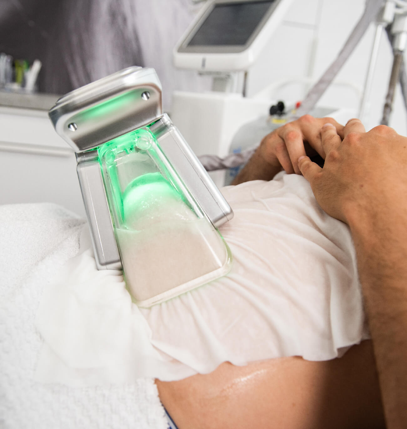 Appareil de cryolipolyse ColdSculpting appliqué sur la zone abdominale d’un client, utilisant la technologie de refroidissement ciblé pour réduire les graisses de manière non invasive.