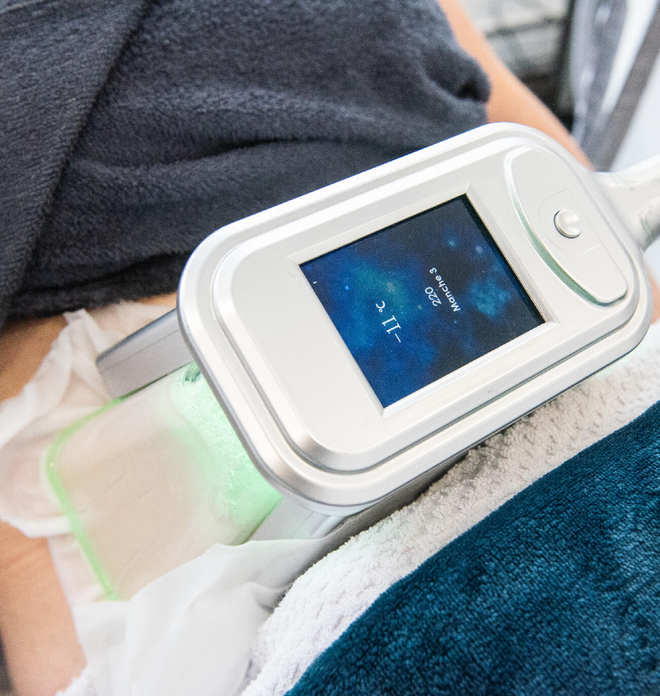 Appareil de cryolipolyse ColdSculpting affichant la température de traitement de -11°C sur l’écran, appliqué sur la zone abdominale pour réduire les graisses de manière ciblée et non invasive.