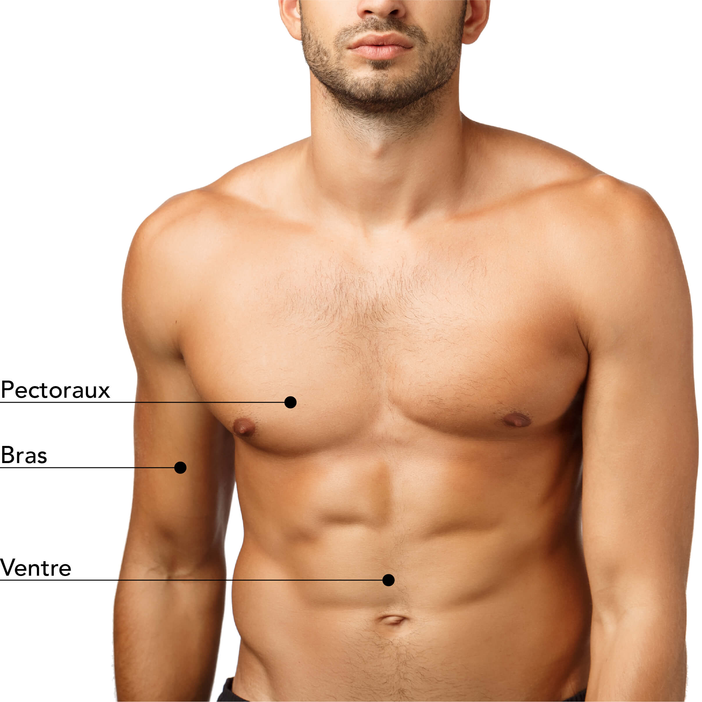 Zones traitables par cryolipolyse : pectoraux, bras et ventre. Découvrez les meilleurs traitements esthétiques comme le ColdSculpting