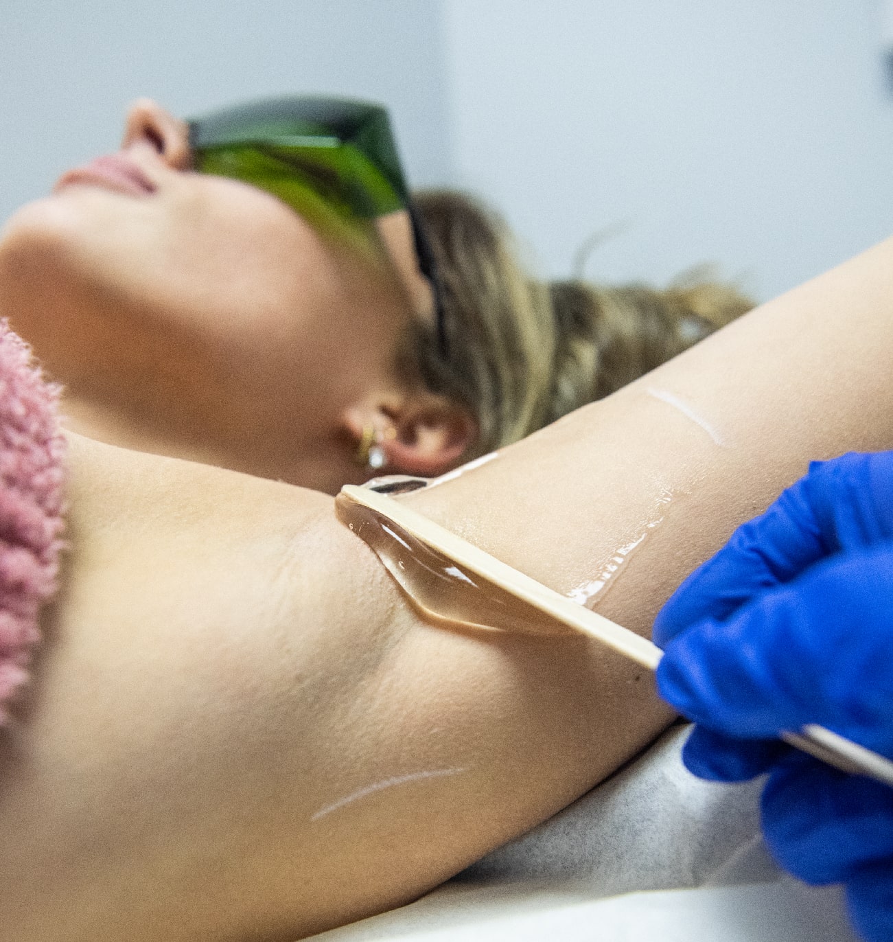 Épilation définitive au laser sous les aisselles pour cibler et détruire les follicules pileux. Le processus offre une solution efficace et durable pour éliminer les poils.