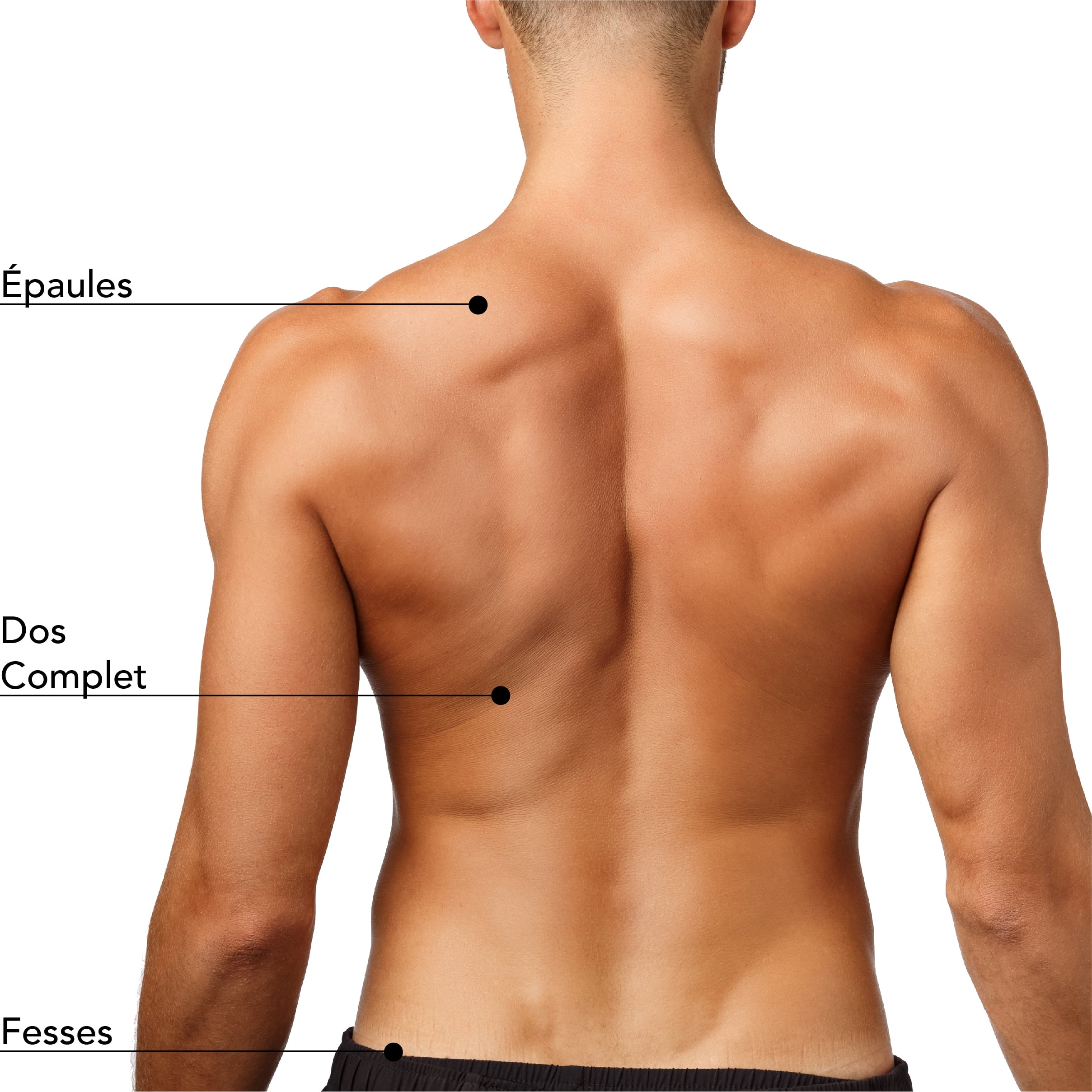 Zones de traitement pour l’épilation laser sur le haut et bas du dos d’un homme, incluant les épaules, le dos complet, ainsi que les fesses. Ces zones sont ciblées pour une épilation définitive et un résultat durable.