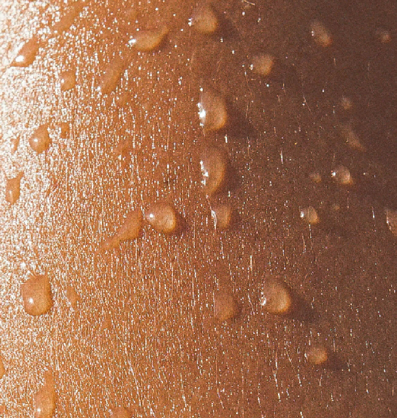 Avantages des injections de l’hyperhidrose : réduction des taches de sueurs sur les vêtements