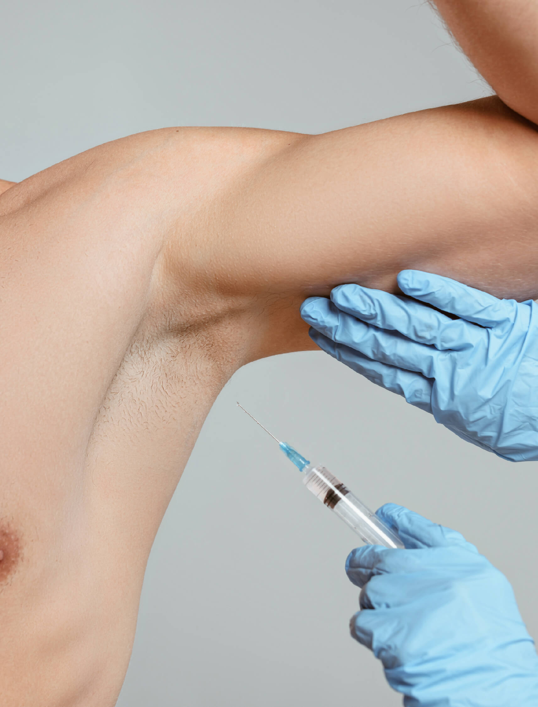 Avantages des injections de l’hyperhidrose : augmentation de la confiance en soi