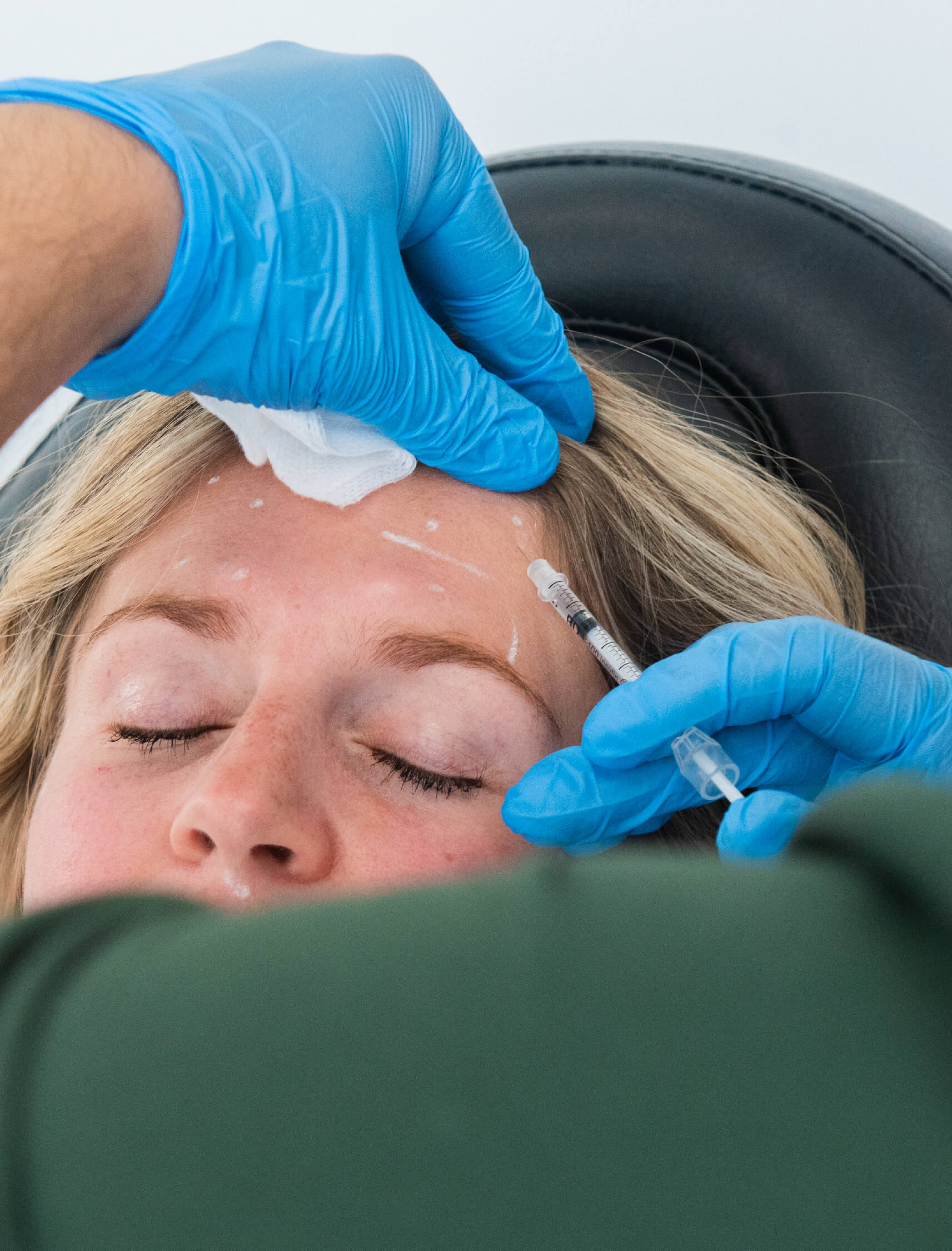 Avantages des injections de neuromodulateurs : prévention de nouvelles rides