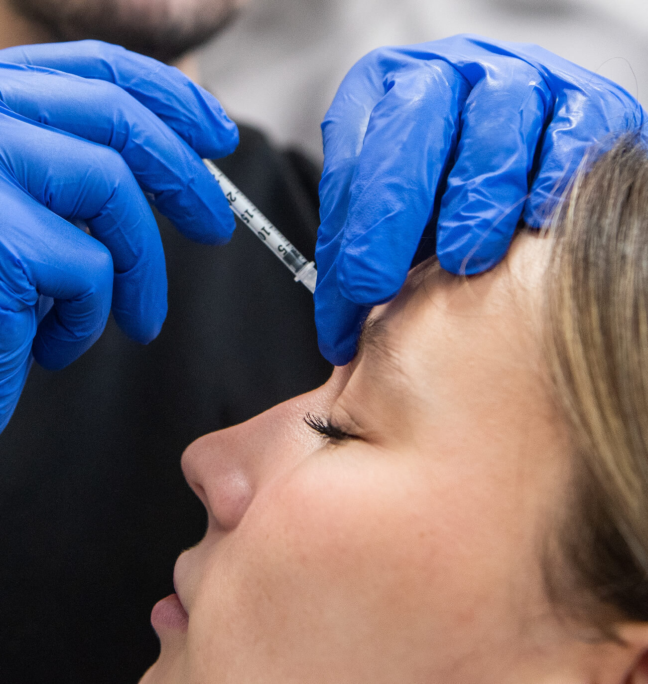 Avantages des injections de neuromodulateurs : amélioration de l’apparence générale