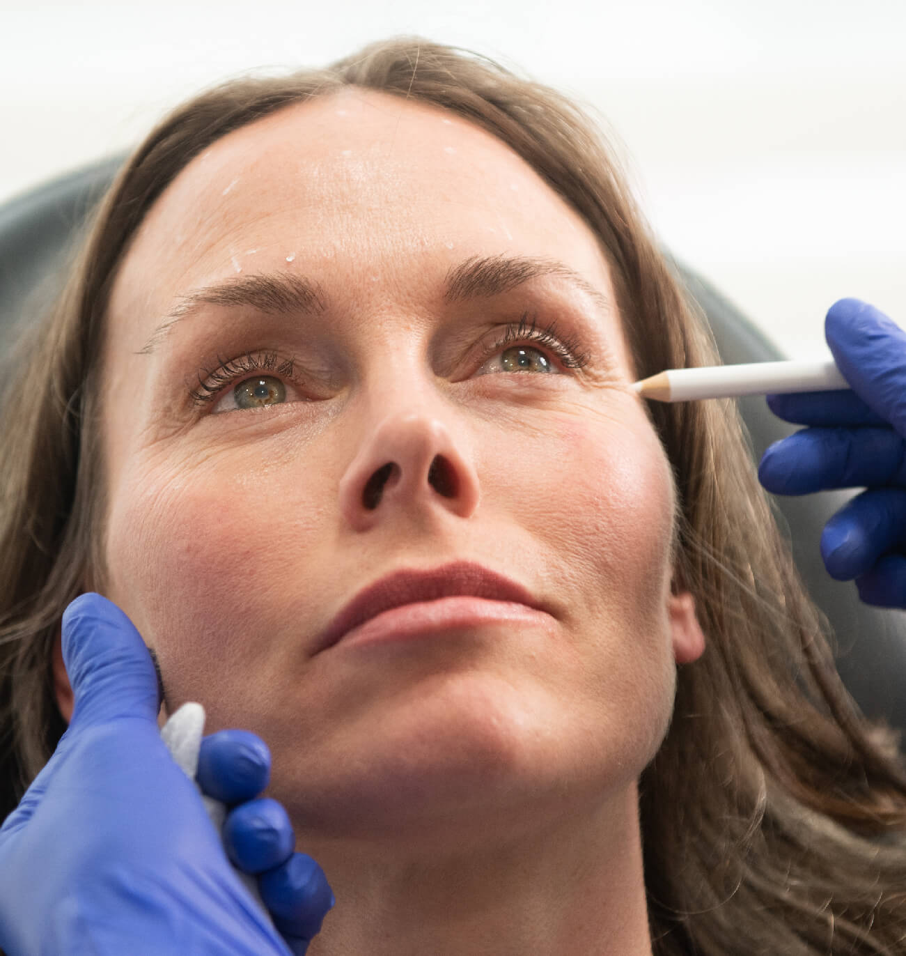 Avantages des injections de neuromodulateurs : résultats naturels
