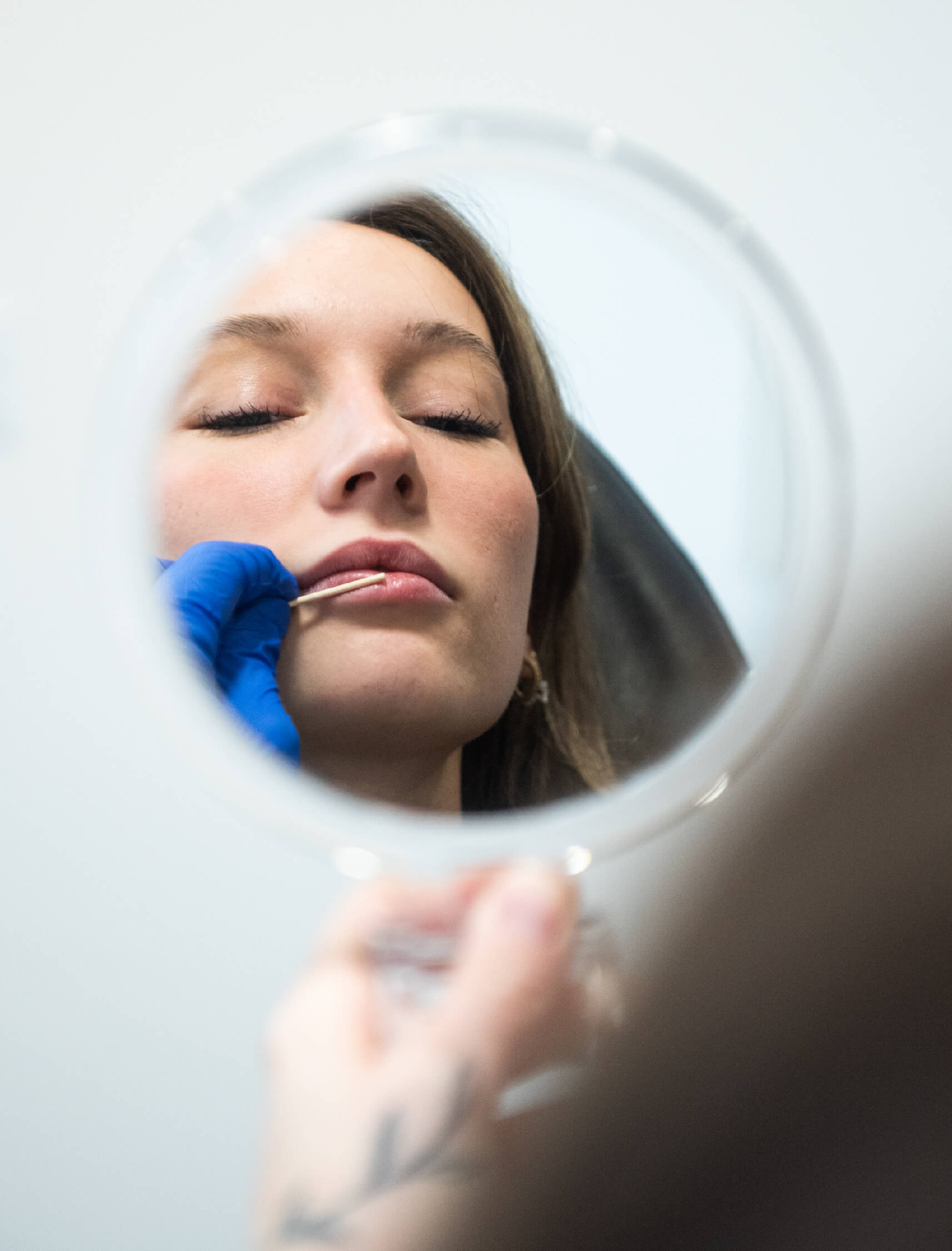 Avantages des injections d’acide hyaluronique : restauration du volume perdu au niveau des joues et des tempes