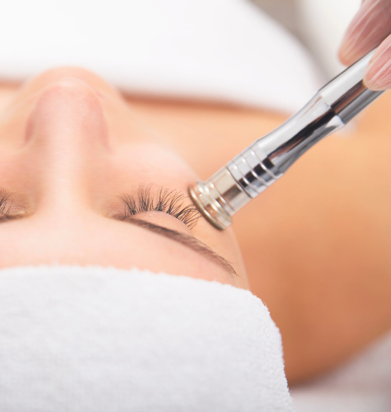 Gros plan d’un traitement de microdermabrasion autour des yeux pour améliorer la texture et l’éclat de la peau.