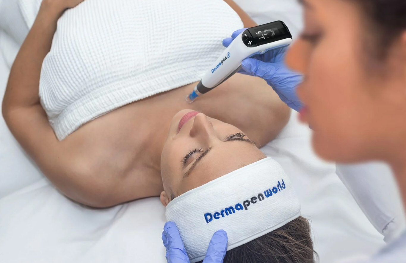 Consultation et déroulement d’une séance de microneedling Dermapen 4 : traitement professionnel pour stimuler la production de collagène, raffermir la peau et atténuer les rides, cicatrices et imperfections. Soin esthétique avancé offert par St-Laurent Médico-Esthétique