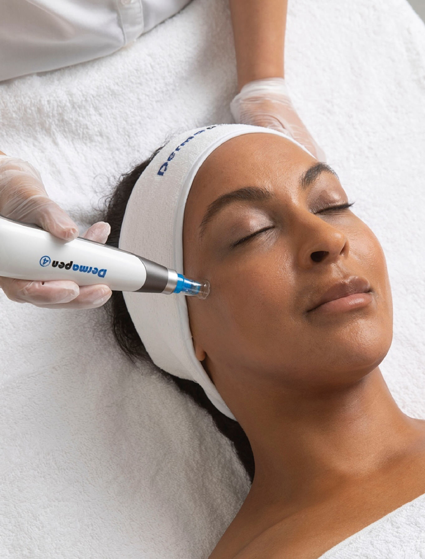Traitement de microneedling Dermapen 4 sur le visage : stimulation du collagène et régénération cutanée pour une peau plus lisse, ferme et lumineuse. Soin professionnel anti-âge et réparateur offert par St-Laurent Médico-Esthétique.