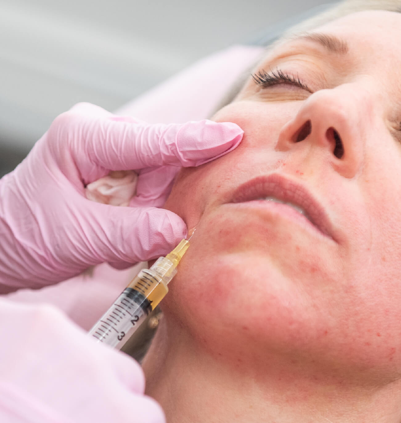 Femme recevant un traitement esthétique par injection ciblée, mettant en avant le troisième avantage