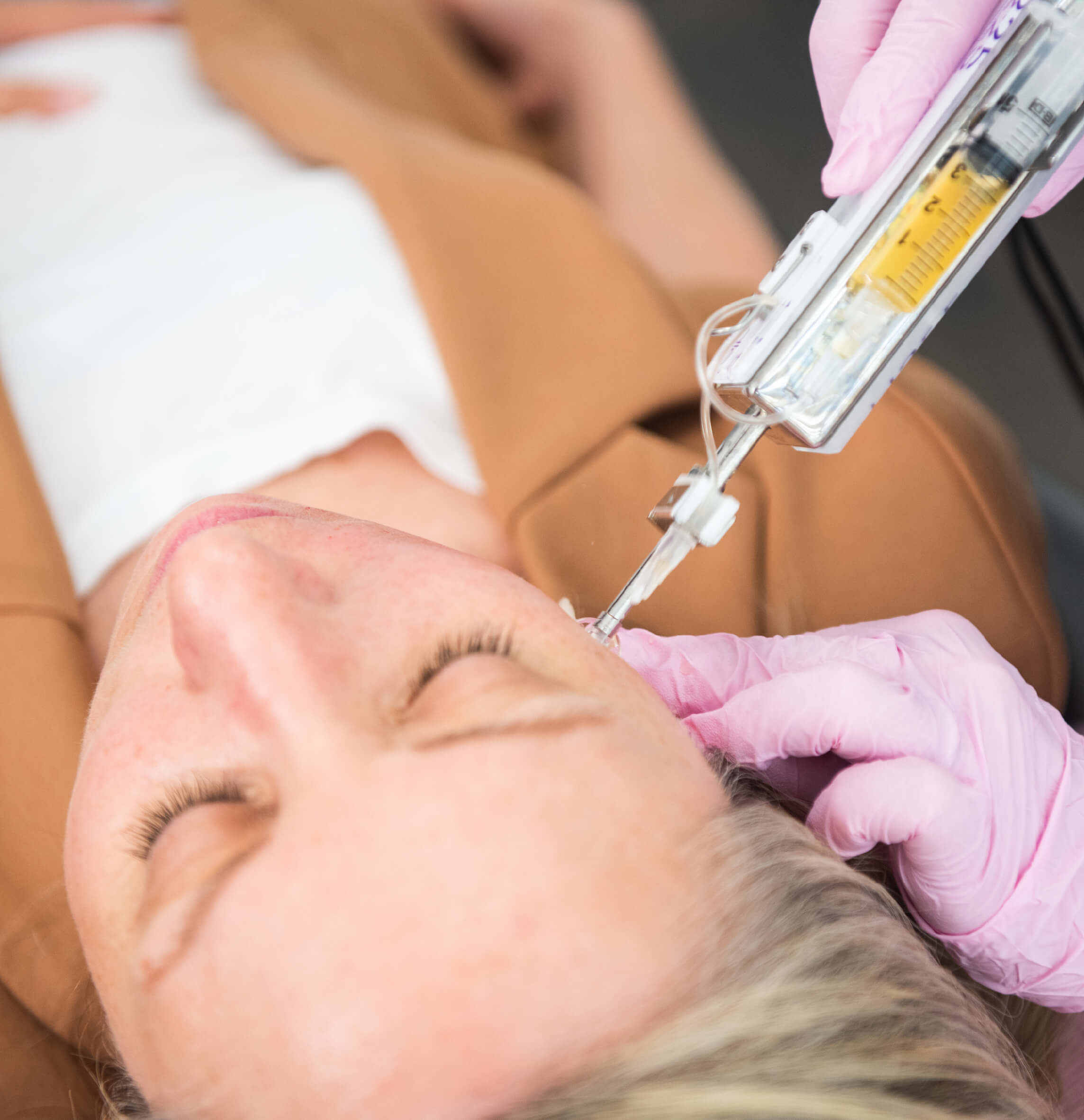 Femme recevant un traitement esthétique par micro-injections avec un dispositif médical avancé, conçu pour améliorer la texture, l’hydratation et la qualité de la peau en clinique spécialisée.