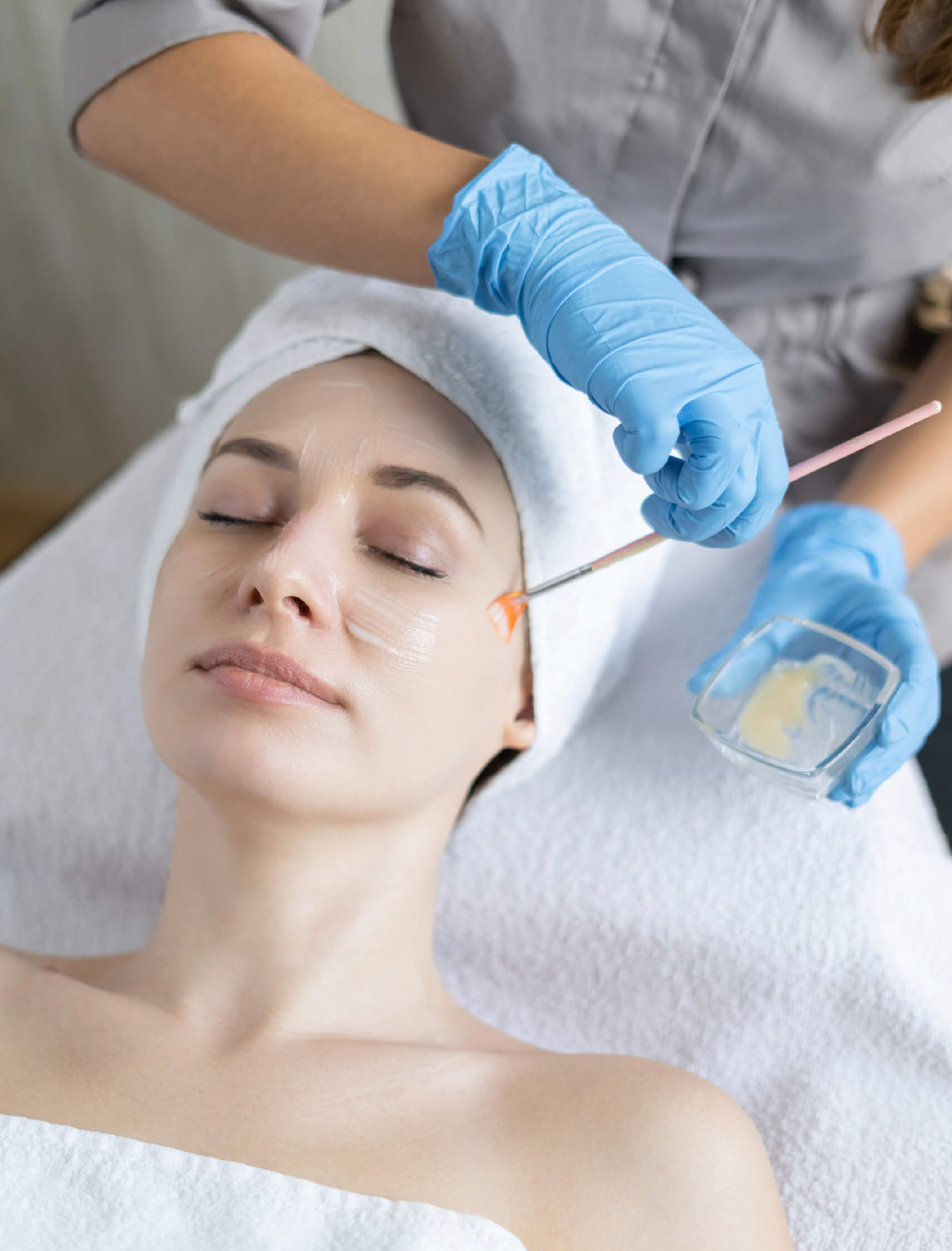Application d’un peeling glycolique au pinceau pour un soin exfoliant et rajeunissant sur le visage, effectué par une esthéticienne professionnelle. Idéal pour une peau lisse et éclatante