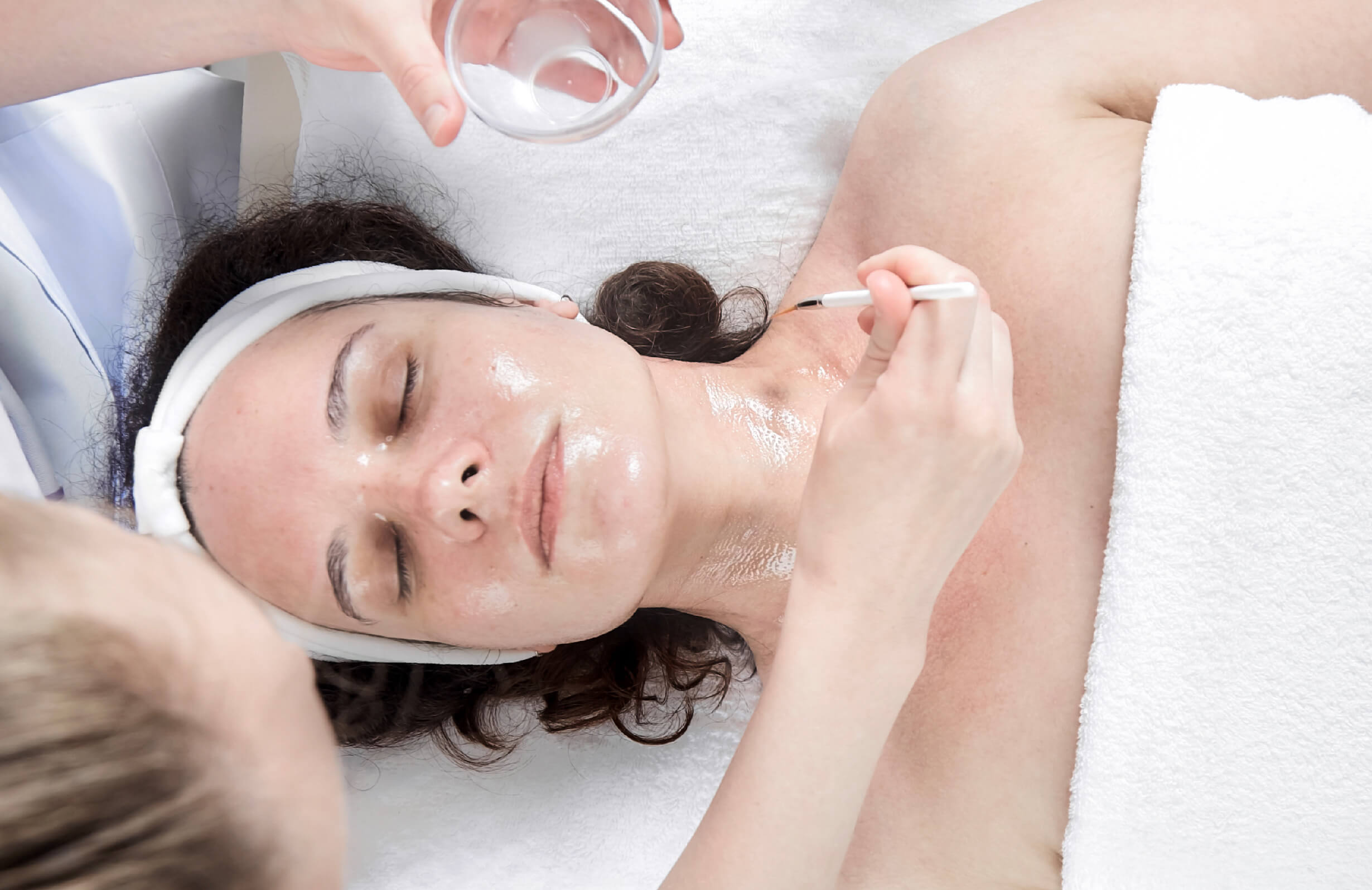Application d’un peeling glycolique professionnel sur le visage et le cou pour une exfoliation en profondeur et un éclat durable. Traitement idéal pour lisser la peau et stimuler le renouvellement cellulaire