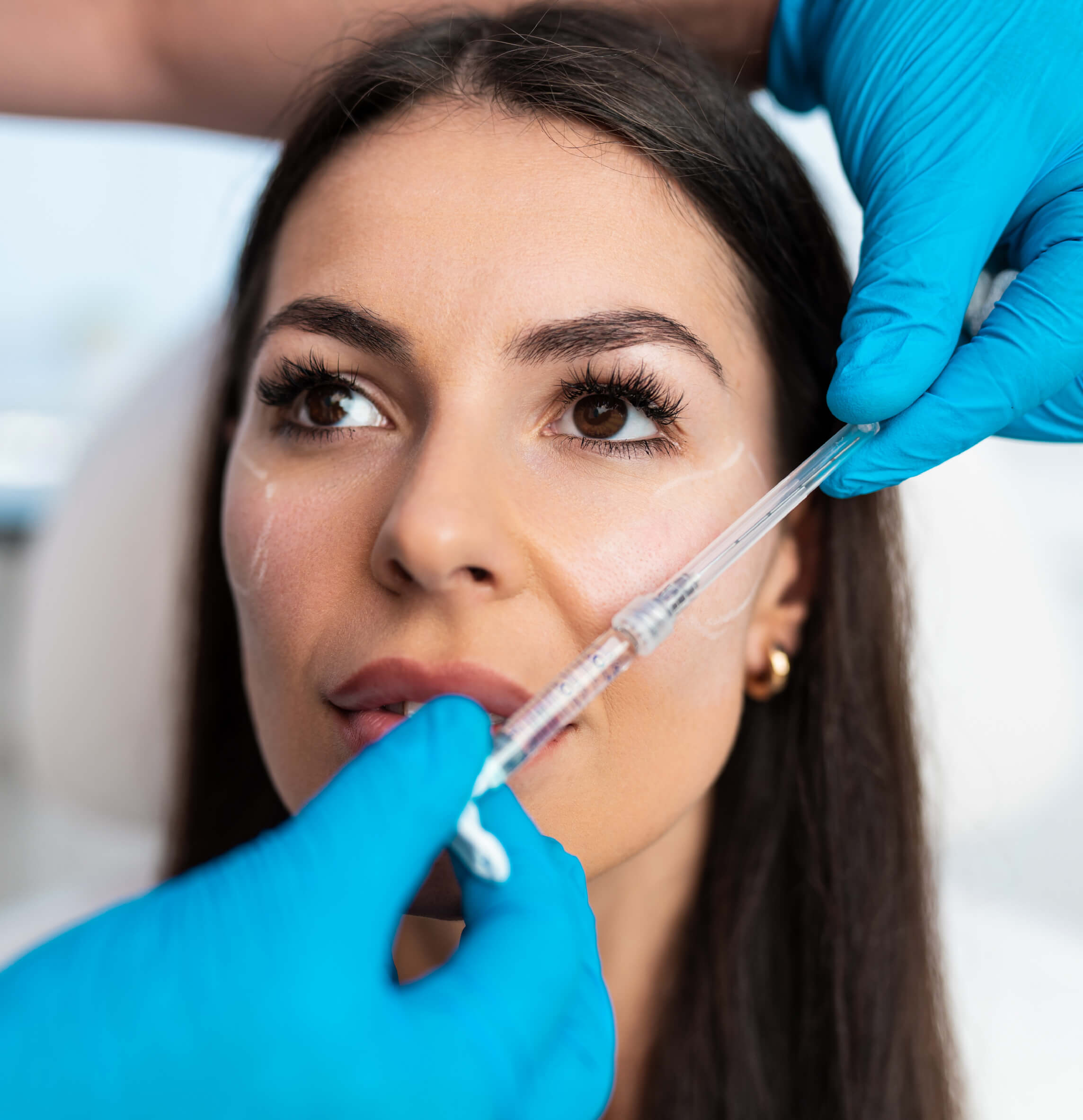 Femme recevant une injection esthétique sur la joue, traitement anti-âge avec acide hyaluronique pour améliorer l’apparence de la peau et réduire les rides en clinique spécialisée.
