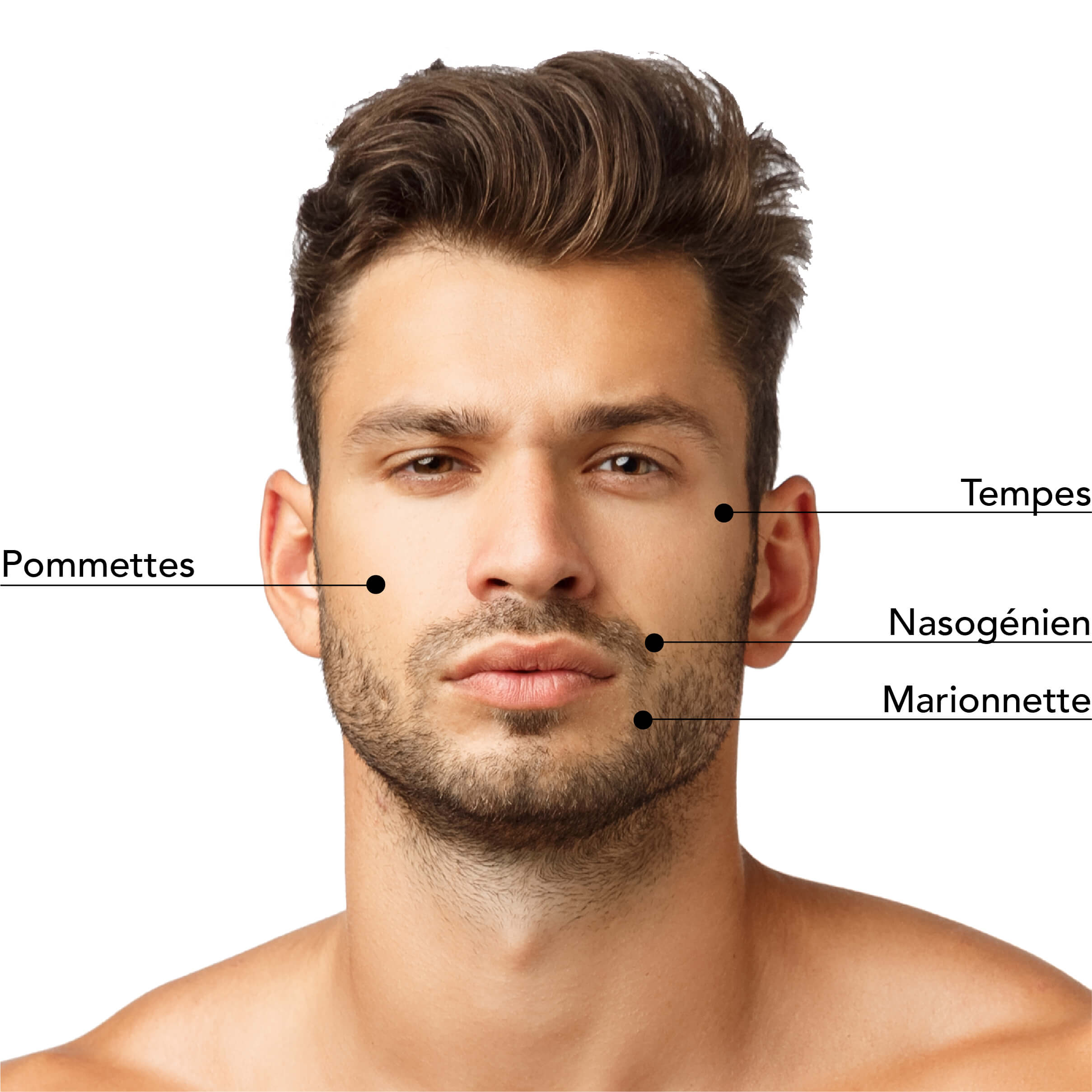 Illustration des zones traitables pour les injections esthétiques chez l’homme, incluant les tempes, les pommettes, les plis nasogéniens et les lignes marionnettes pour un rajeunissement et une amélioration naturelle du visage.
