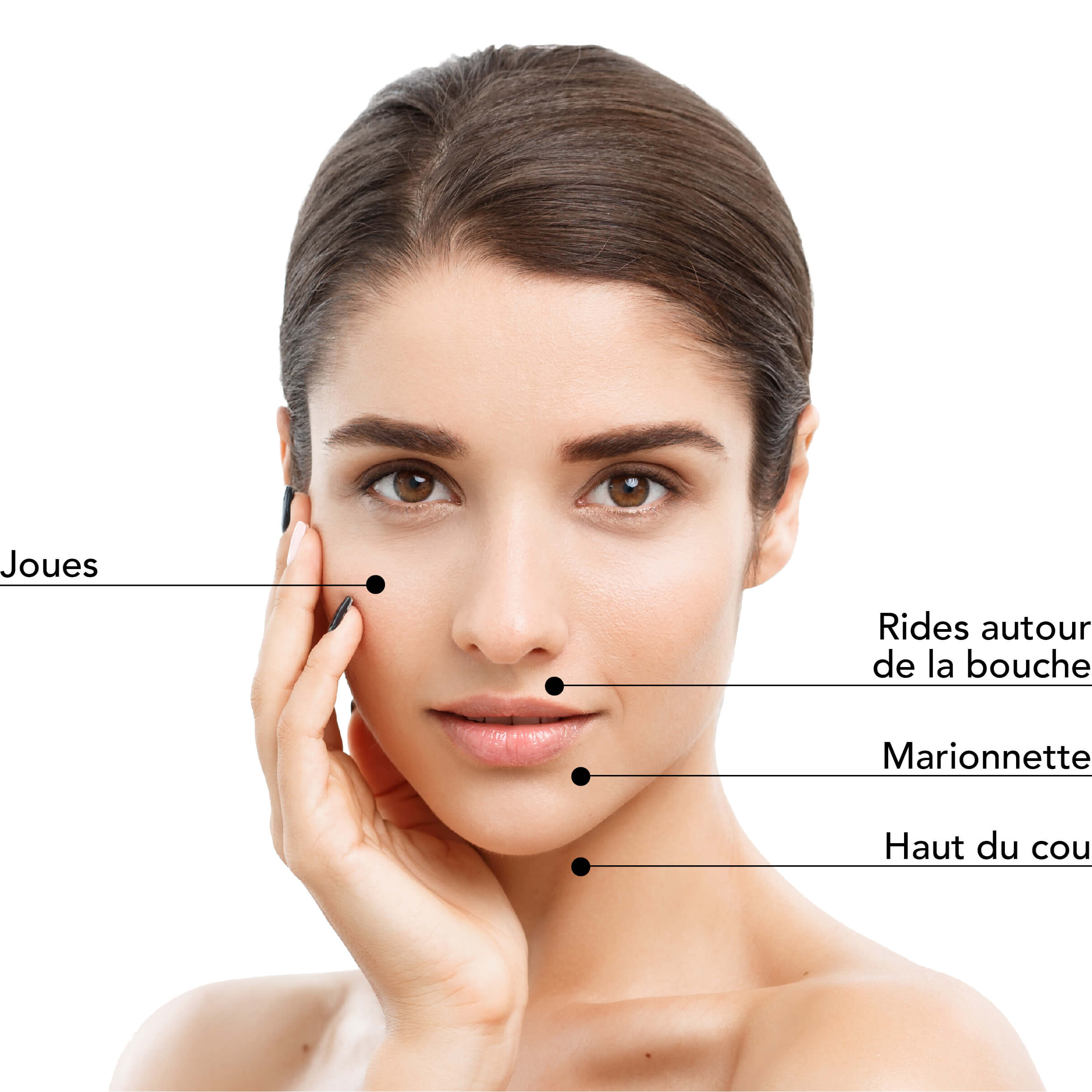 https://identia.digital/stlaurent/wp-content/uploads/2024/05/St-Laurent-Medico-Esthetique_SkinBoosters-Galderma_Zones_traitable_2.jpg