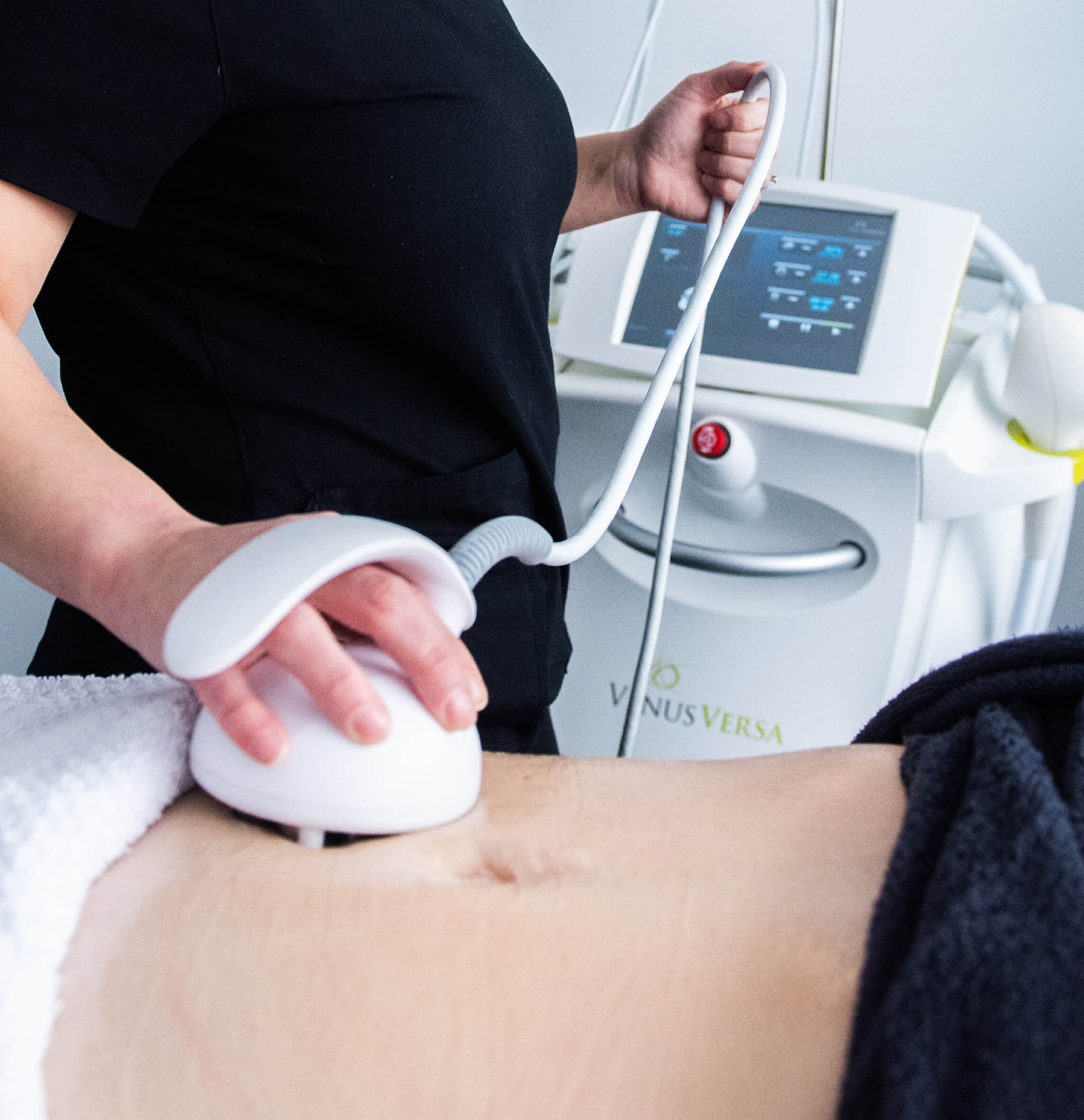 Traitement Venus Freeze en cours : application de la radiofréquence multipolaire et champs magnétiques sur l’abdomen pour raffermir la peau, réduire la cellulite et stimuler la production de collagène. Soin esthétique avancé offert par St-Laurent Médico-Esthétique