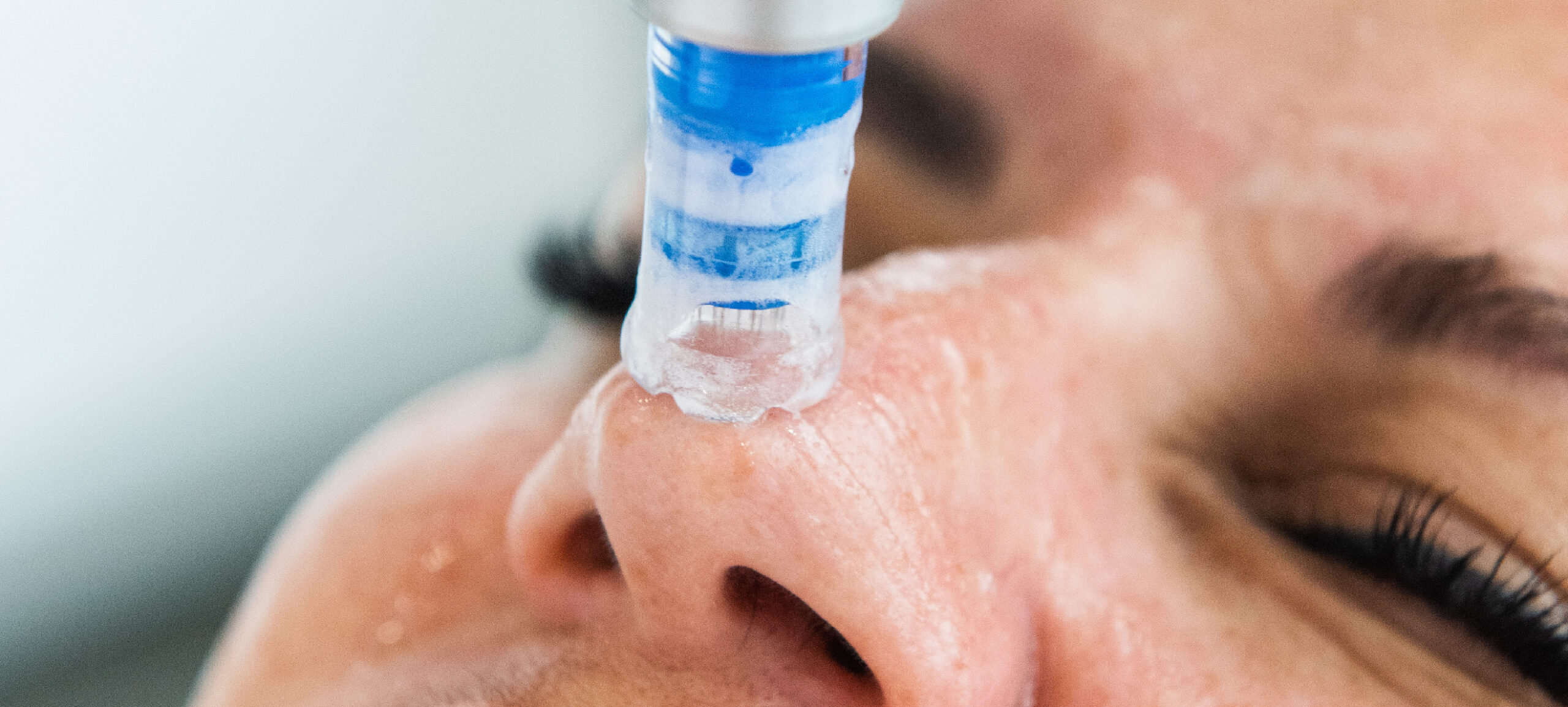 Microneedling 101 : Qu’est-ce que c’est et à quoi s’attendre?