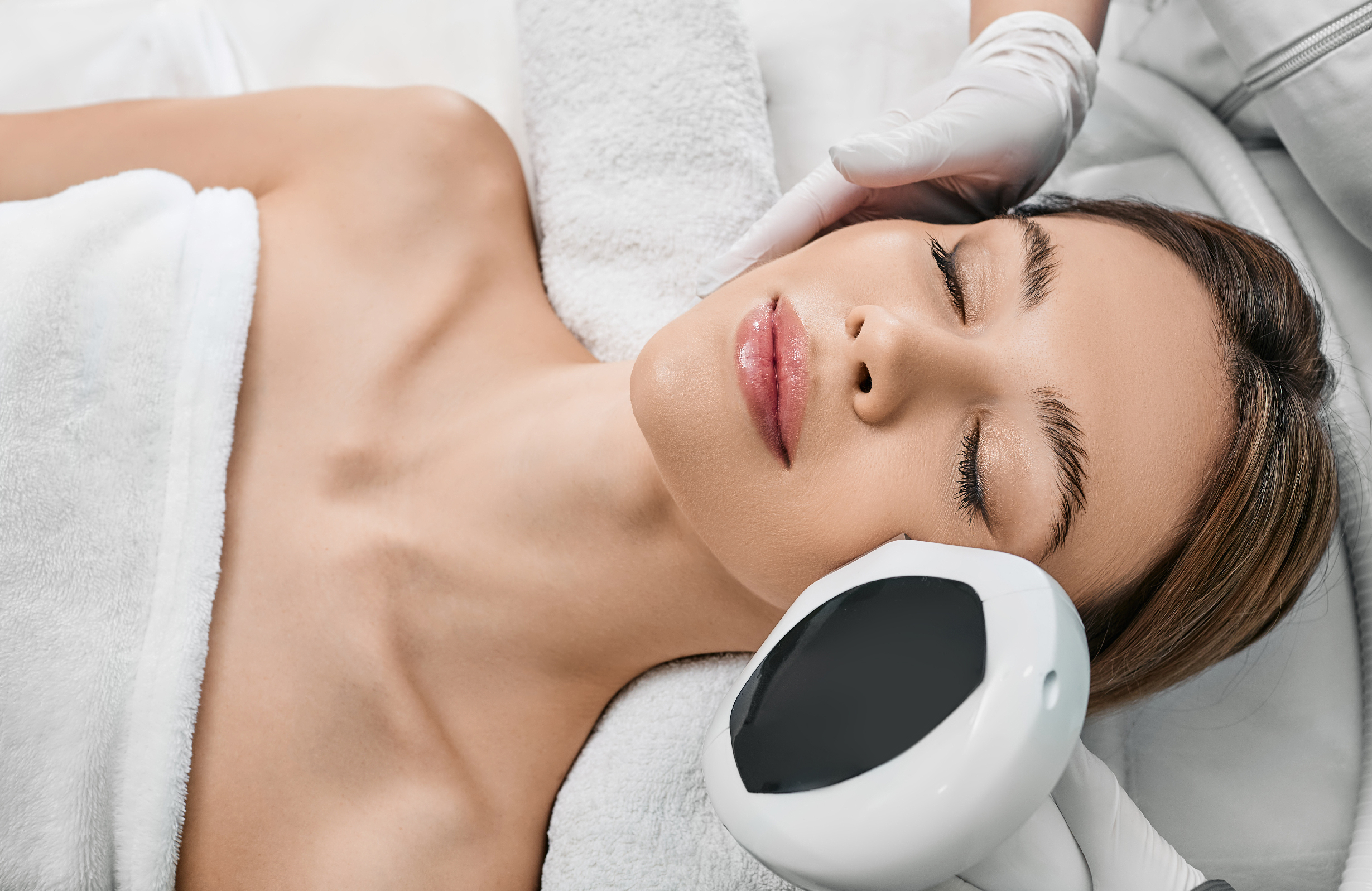 Traitement IPL en cours pour réduire les rougeurs et améliorer l’éclat de la peau, réalisé en clinique par un professionnel.