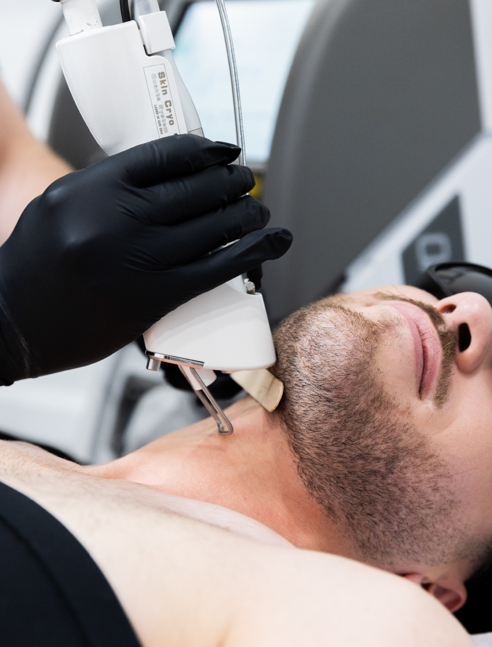 Épilation laser du cou et de la barbe pour un contour net et soigné, réalisée avec la technologie Skin Cryo en clinique esthétique