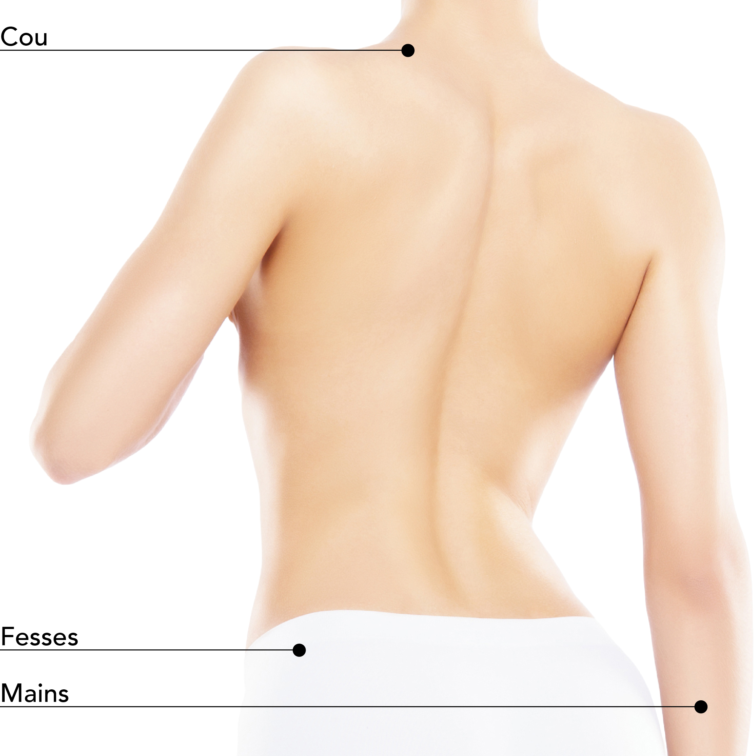 https://identia.digital/stlaurent/wp-content/uploads/2025/08/Zones-Traitables_Dos_Femme_Sculptra.jpg