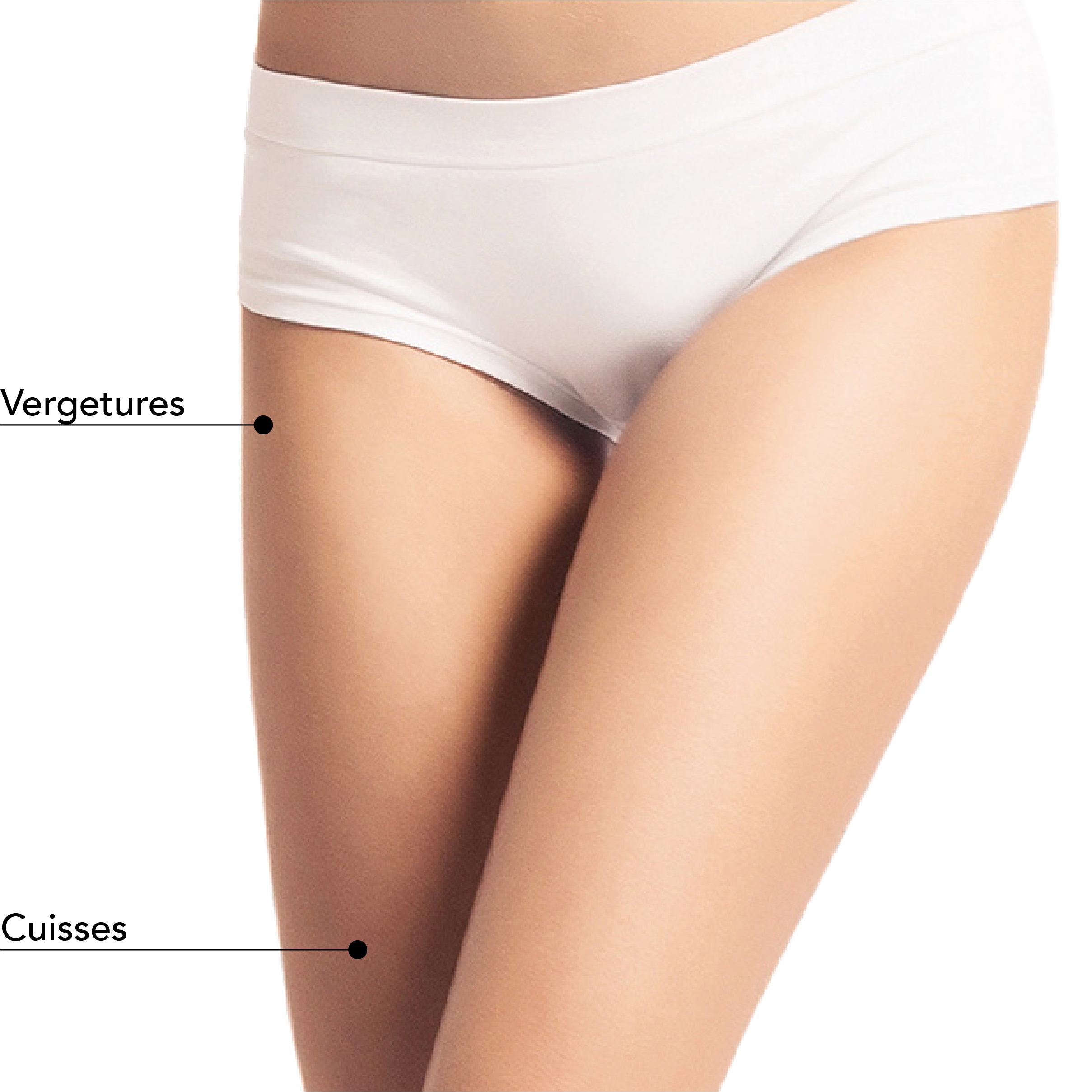 https://identia.digital/stlaurent/wp-content/uploads/2025/08/Zones_Traitables_Jambes_Femme_Laser-CO2.jpg