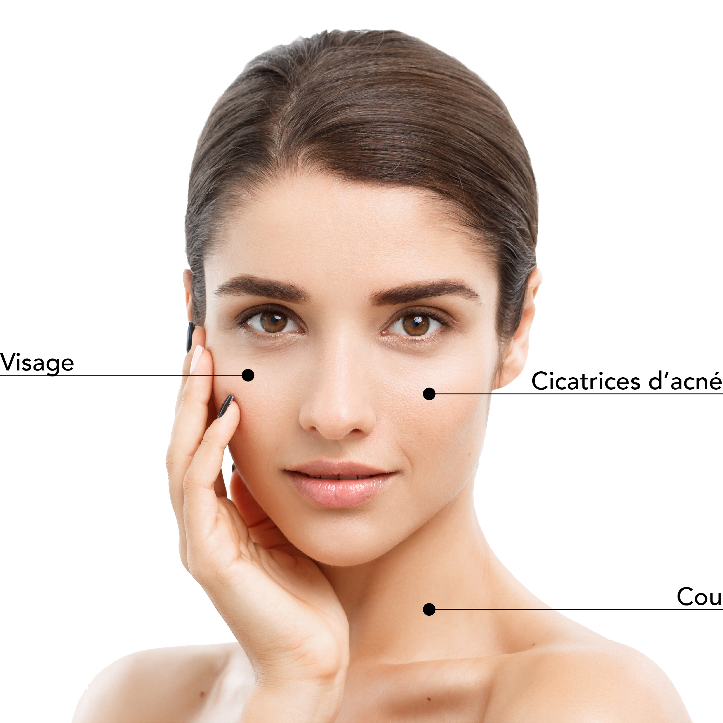 https://identia.digital/stlaurent/wp-content/uploads/2025/08/Zones_Traitables_Visage_Femme_LaserCO2.jpg